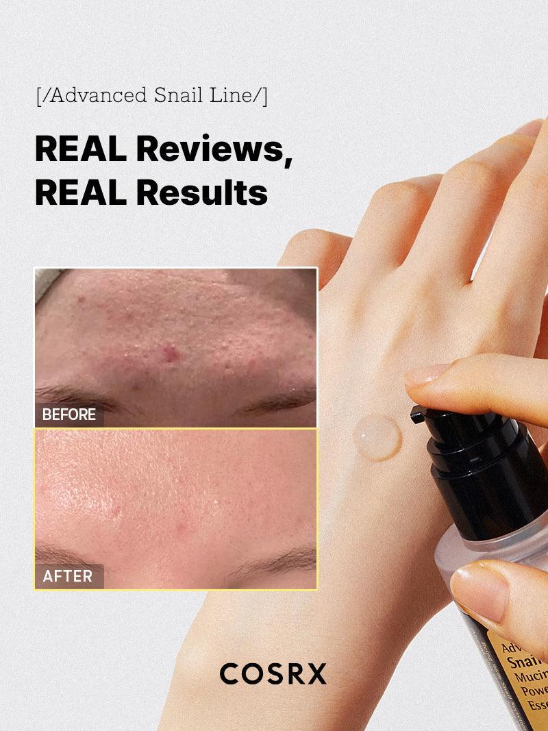 COSRX Advanced Snail 96 Mucin Power Essence 100ml | Korean Skincare Hydrating Serum for Repair & Glow